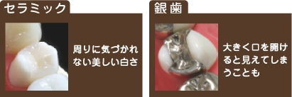 �Z���~�b�N�Ƌ⎕